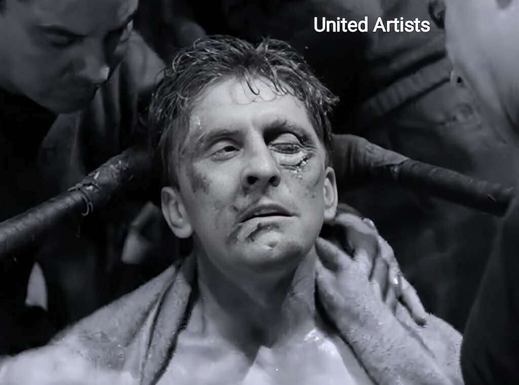 A black and white picture of a boxer sitting in the corner with bruised eyes and face.